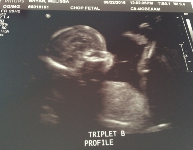 fullsizerender-copy-4